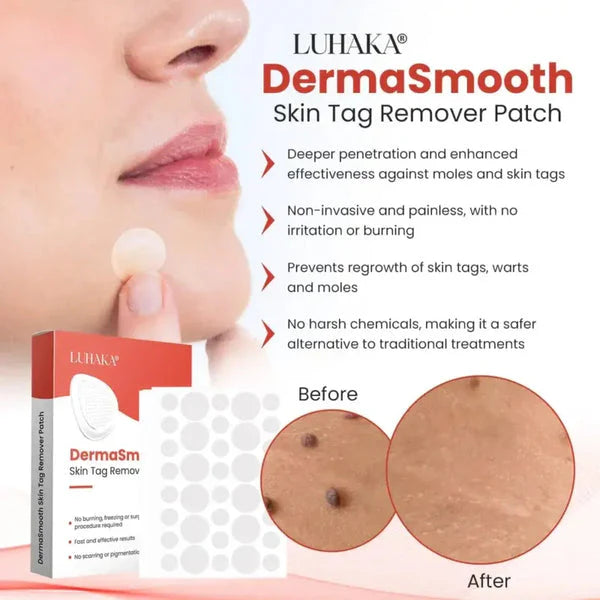 DermaSmooth Skin Tag Remover