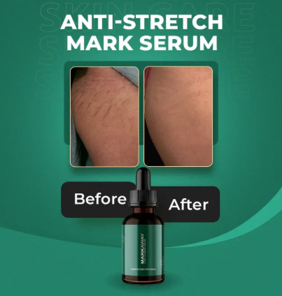 Markaway Stretch Mark Serum